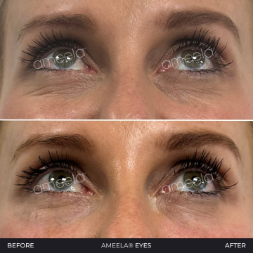 Ameela-Eyes---2