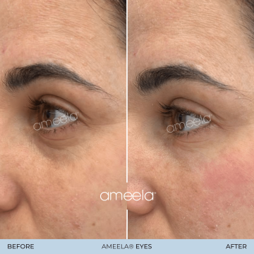 Ameela-Eyes---9