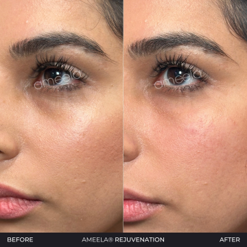 Ameela--Rejuvenation---3