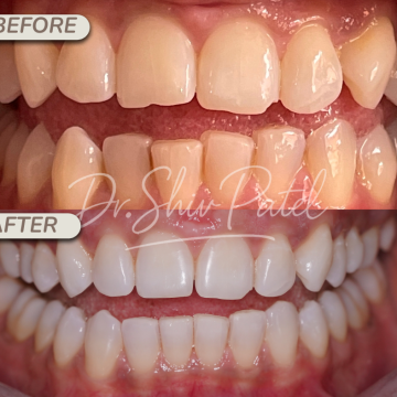 Copy of Whitening (Facebook Post (Landscape)) (1)