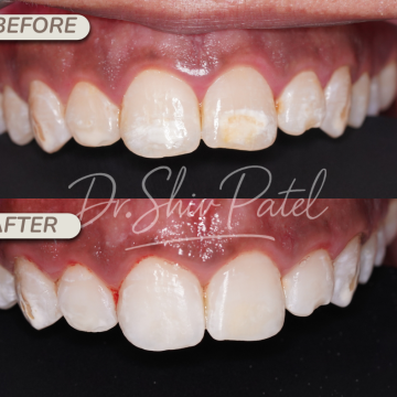 Copy of Whitening